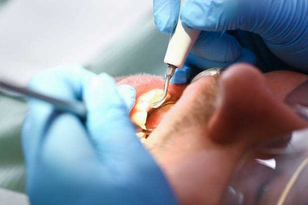 Best Orthodontic Emergency Dentist in Silsbee, TX