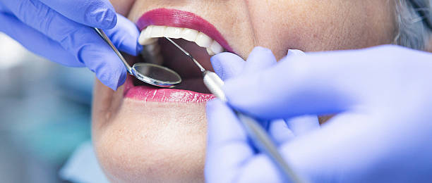 Best Emergency Dentist for Lost Fillings or Crowns in Silsbee, TX