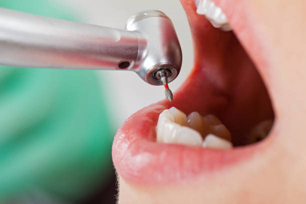 Best Pediatric Emergency Dentist in Silsbee, TX
